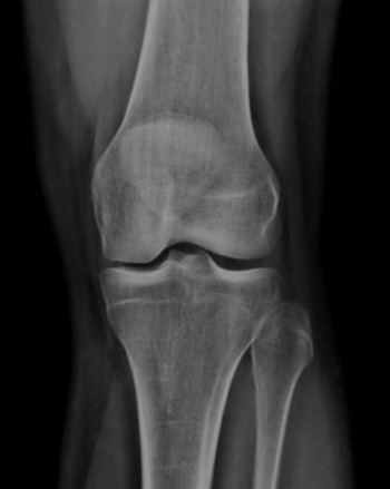 Röntgenbild eines gesunden Knies
