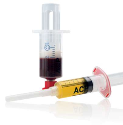 ACP syringe