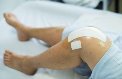Gebeugtes Knie eines Patienten nach Knieprothese mit einem Pflasterverband