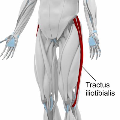 Schematische Abbildung des Oberschenkels mit Darstellung des Tractus iliotibialis von der Seite