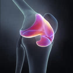 Therapy for cartilage defects